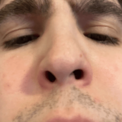 stachzer